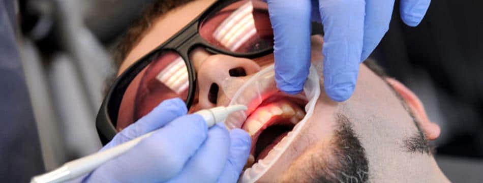dentist using diode laser