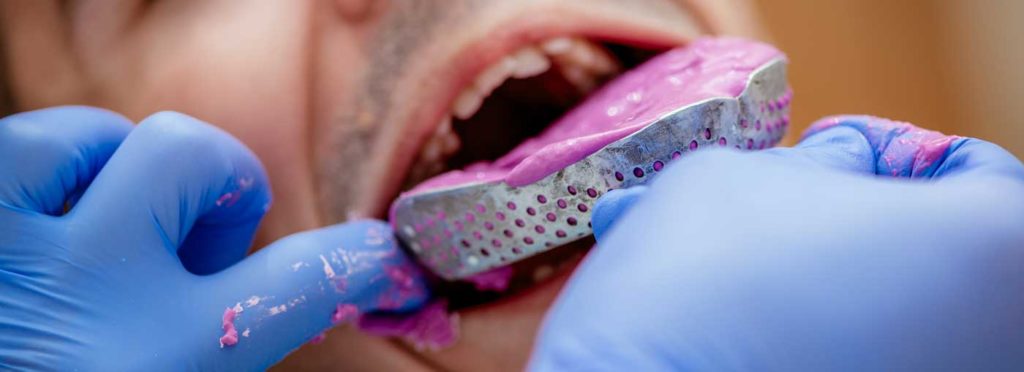 Why Do I Gag at the Dentist? - Drews Dental — Lewiston-Auburn, ME