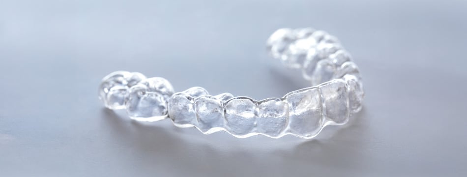upper arch clear aligner