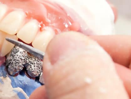 close up of someone's hands crafting a set of dentures