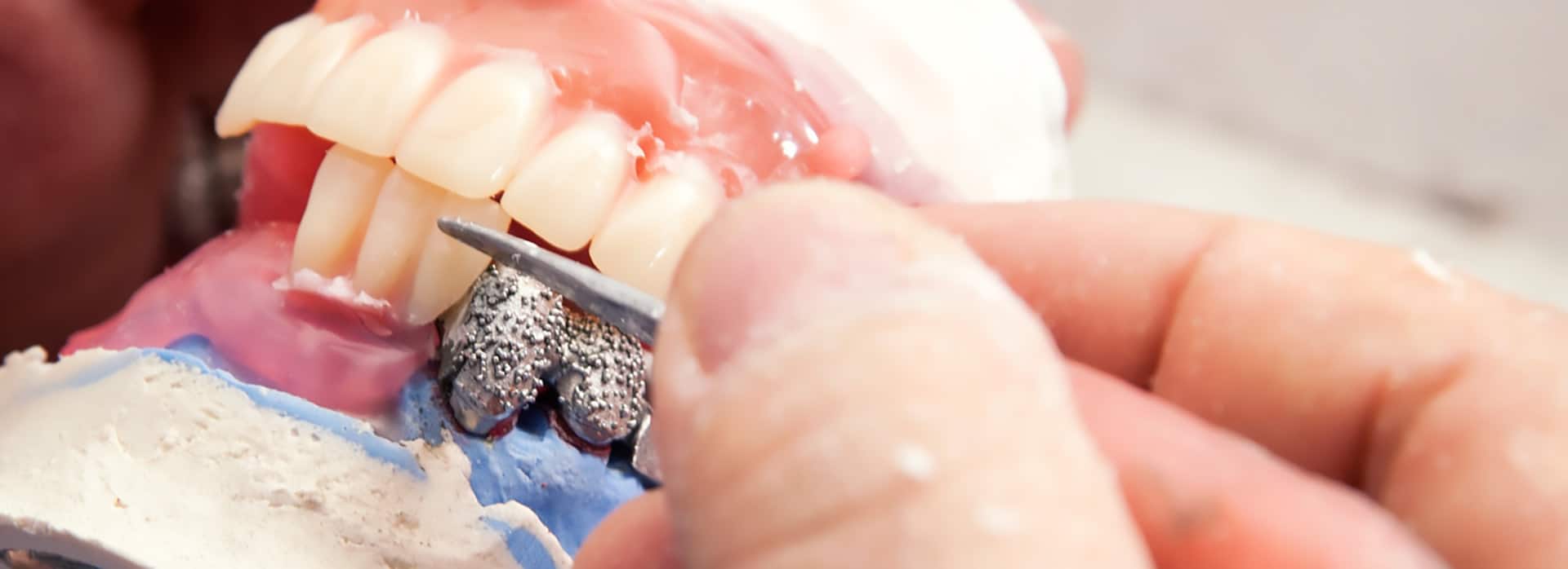 The Effects of Poor Fitting (Loose) Dentures Drews Dental in Lewiston, ME