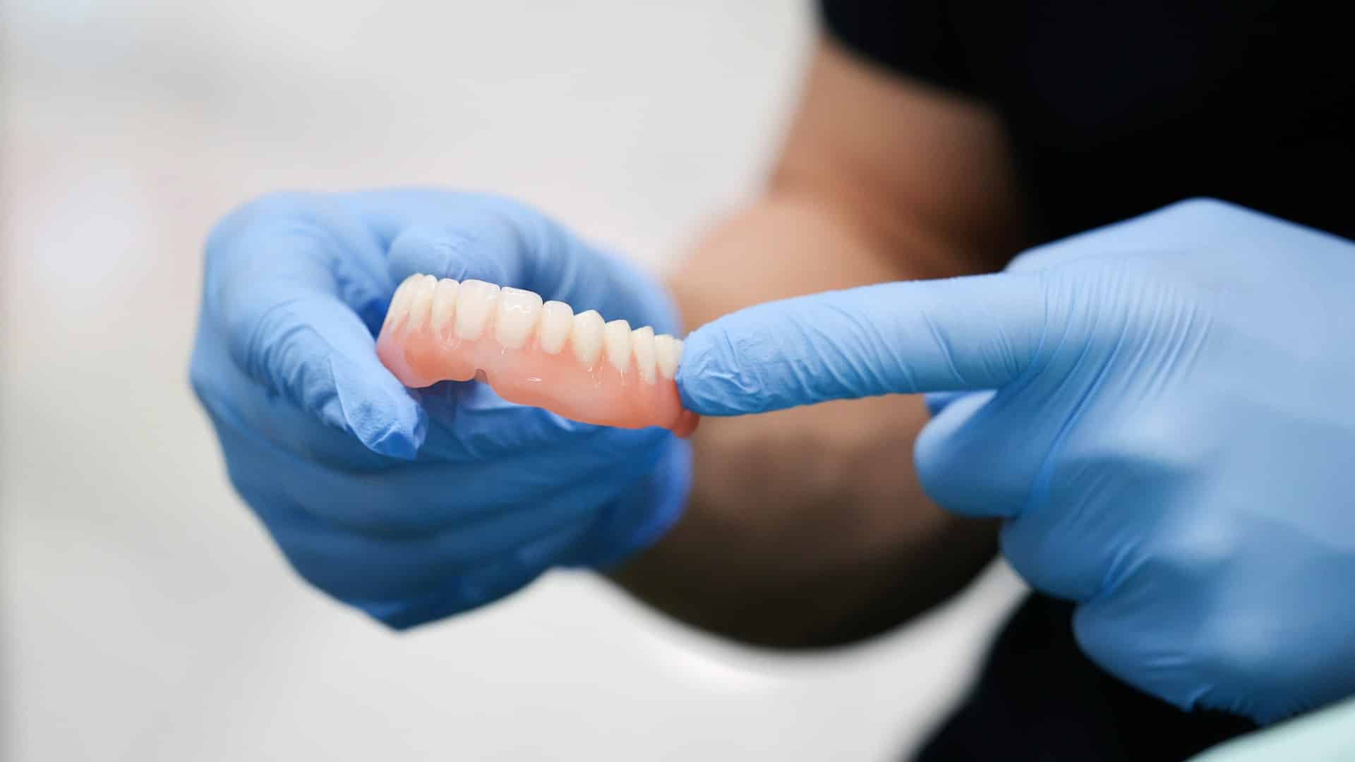 Dental professional holding an upper denture during patient care.