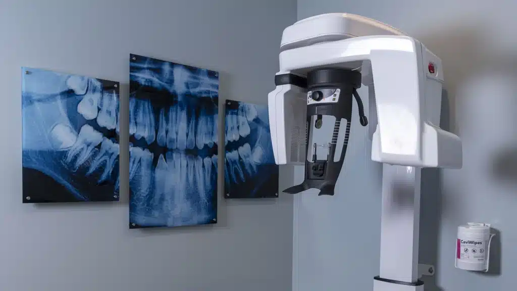 xray machine at Drews Dental Services