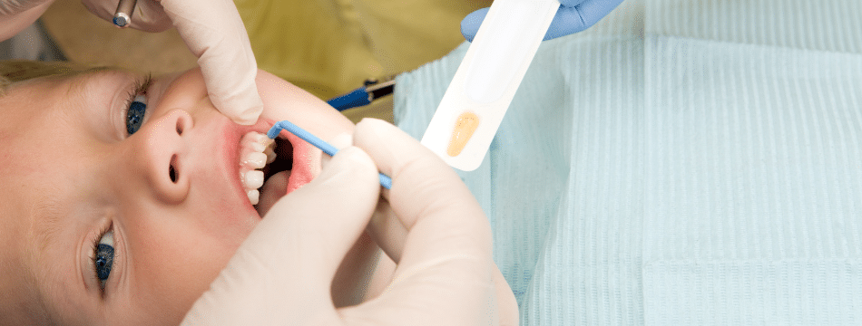 young dental patient getting fluoride treatment